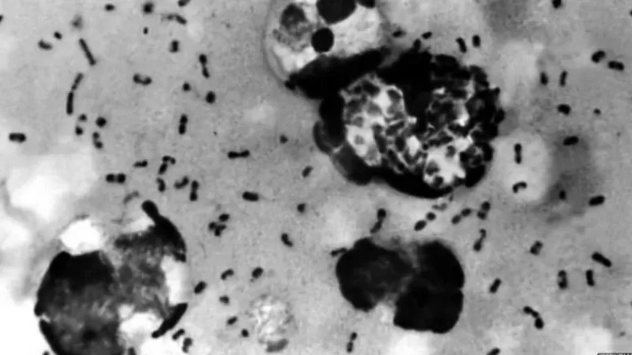 bacteria
