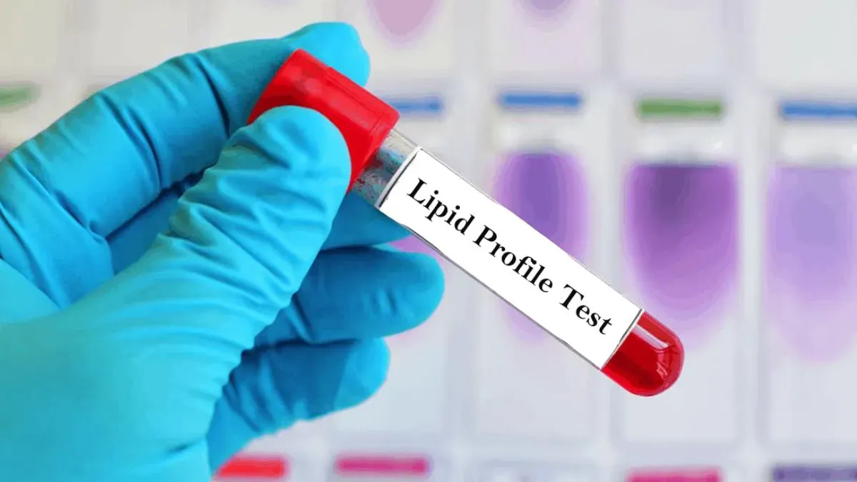 lipid profile