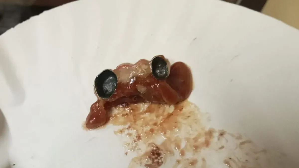 mp, khargone, teeth, chocolate, news