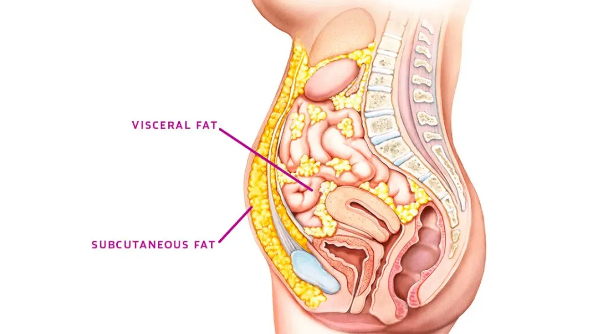 belly fat types