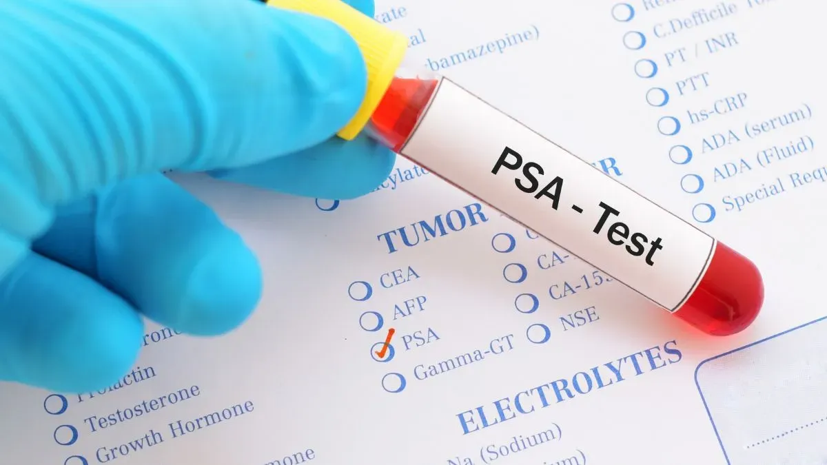 psa test