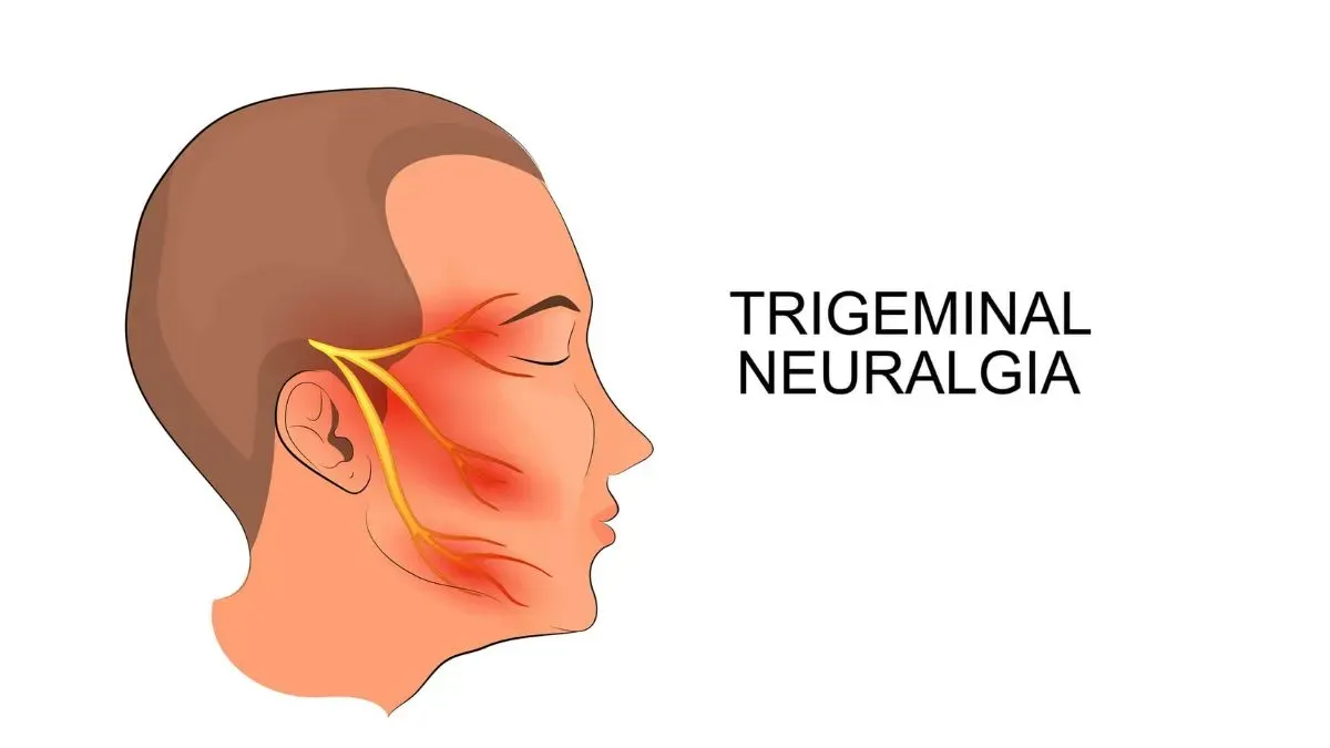 trigeminal neuralgia