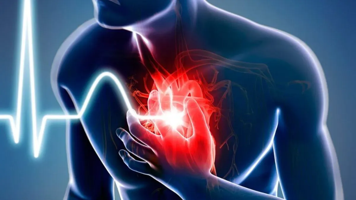 heart attack