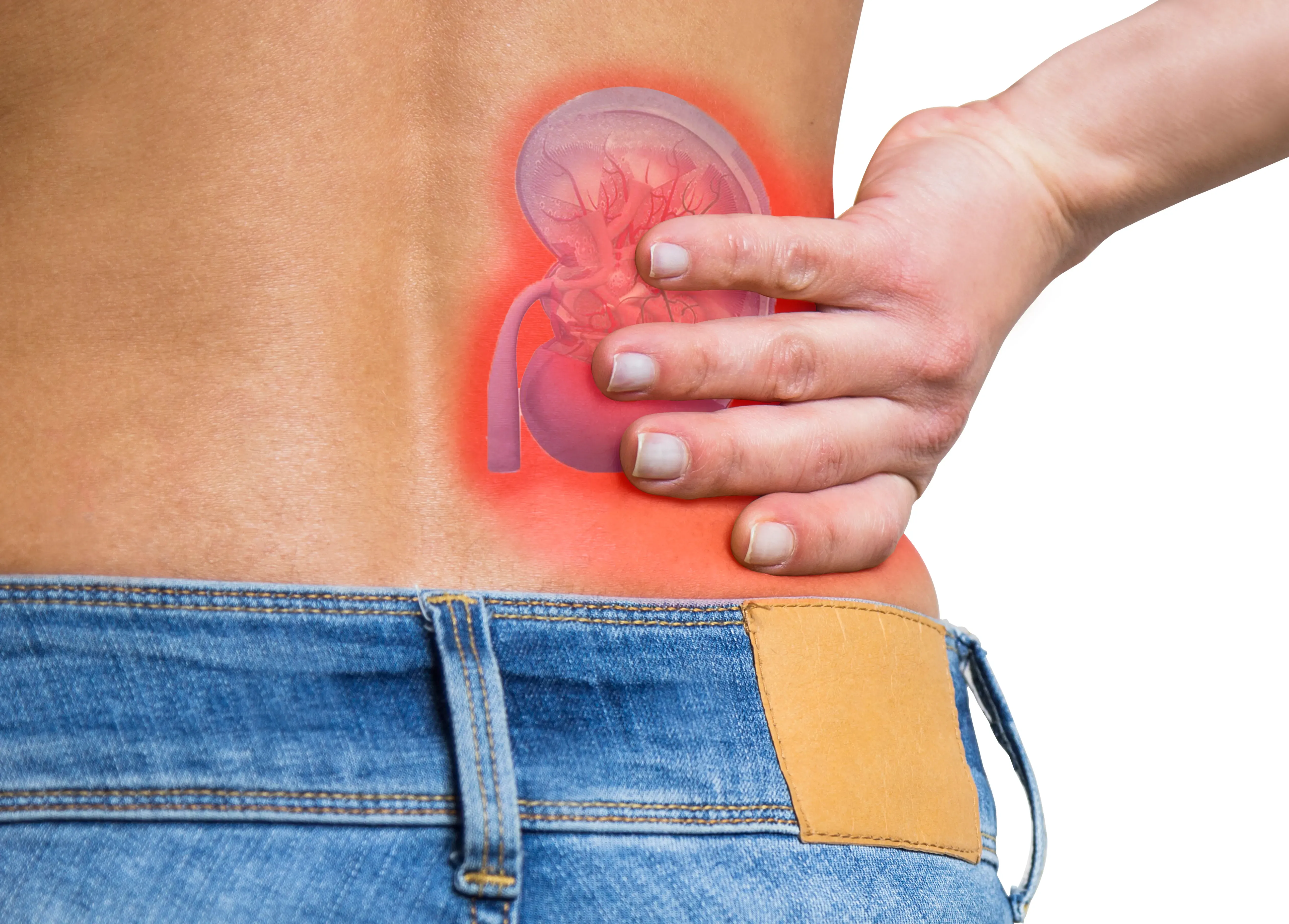 acute kidney injury