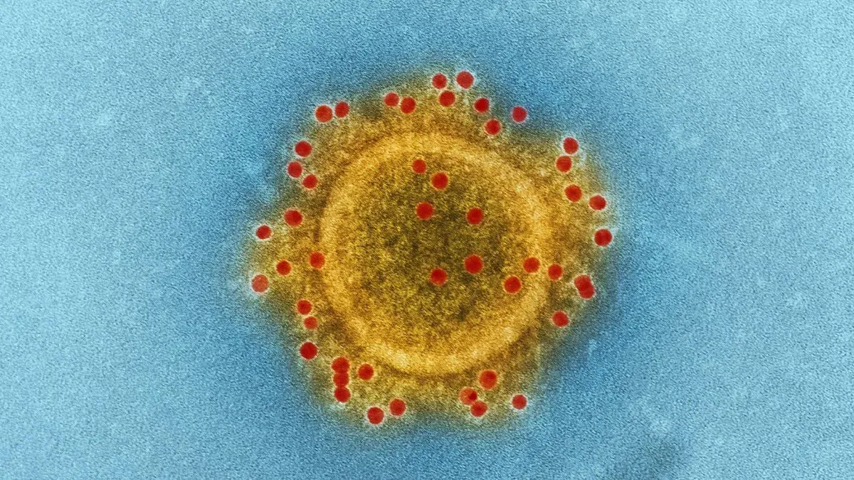 virus