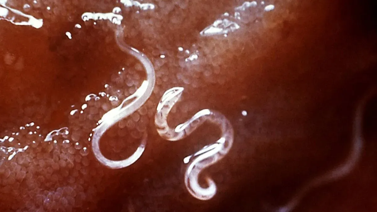 worms in body
