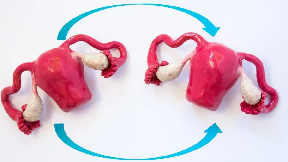 womb transplant