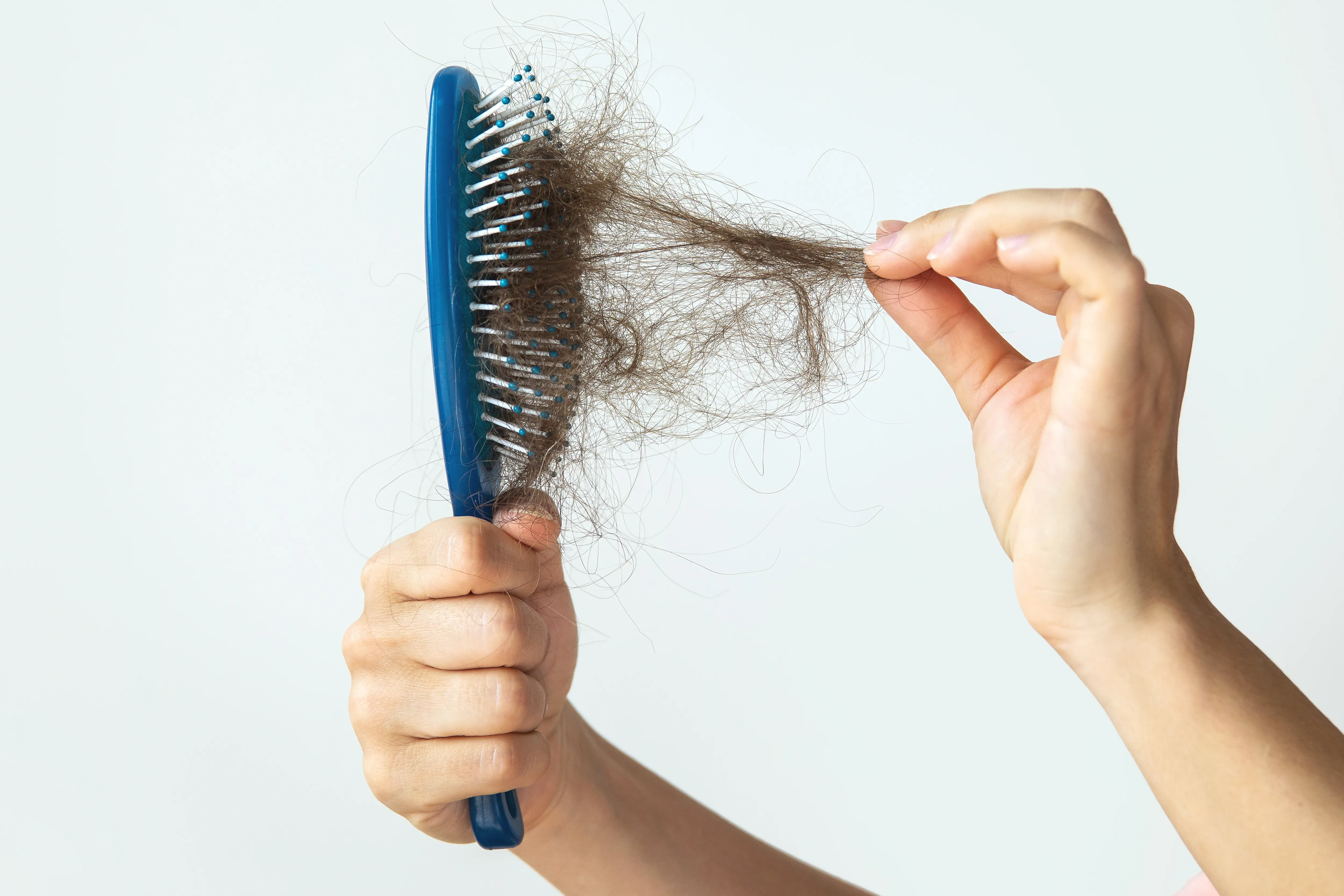 hair loss