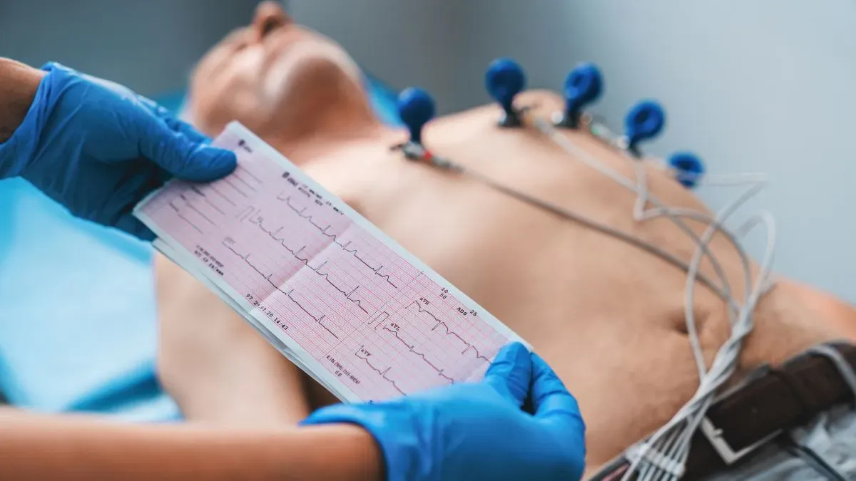 ECG