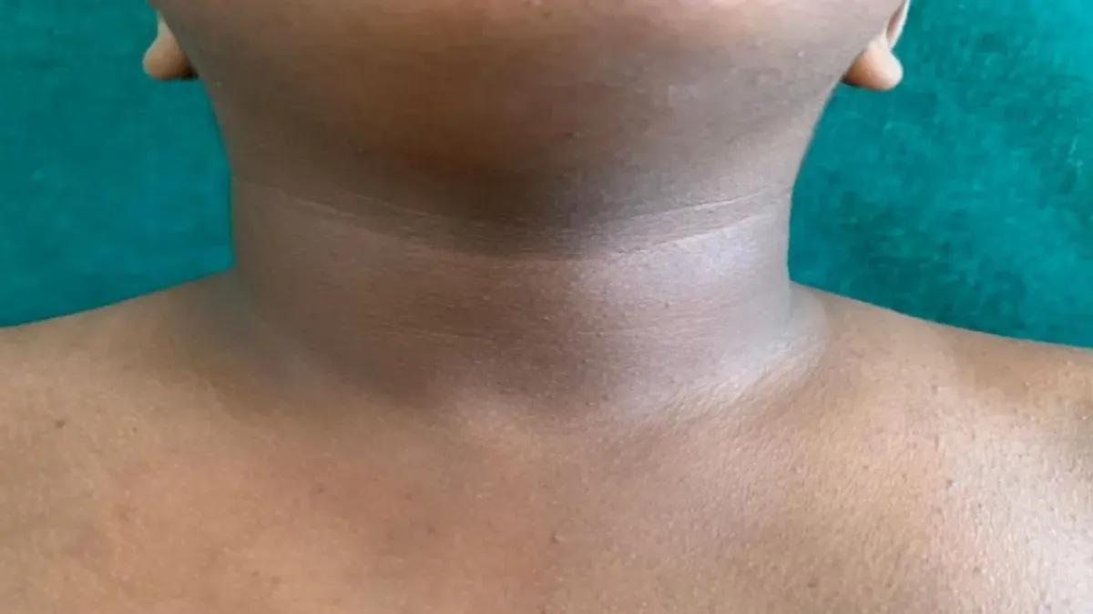 dark neck