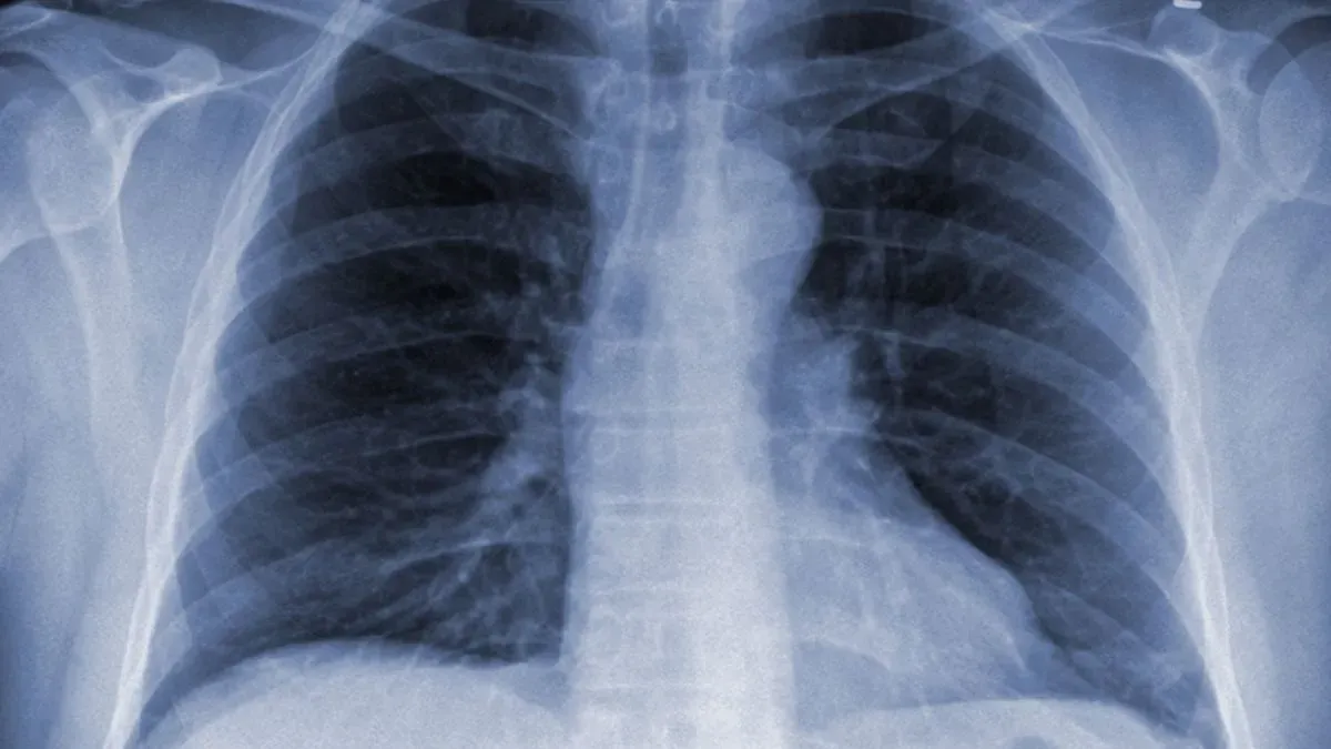pneumonia test