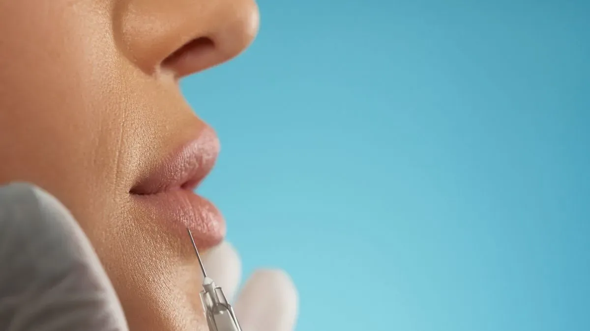 lip filler dissolve