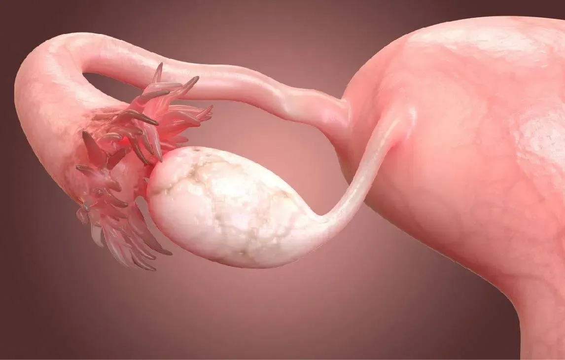 fallopian tube
