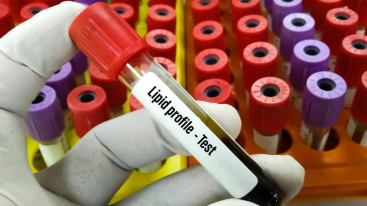 lipid profile