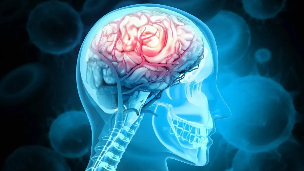 brain inflammation