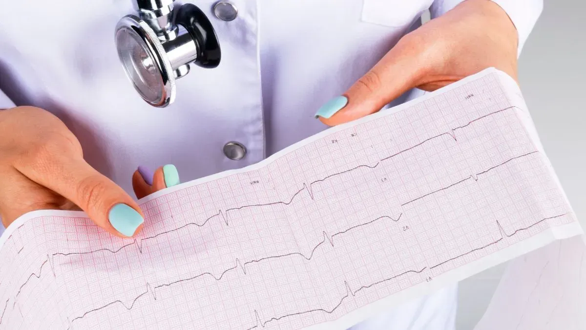 ecg