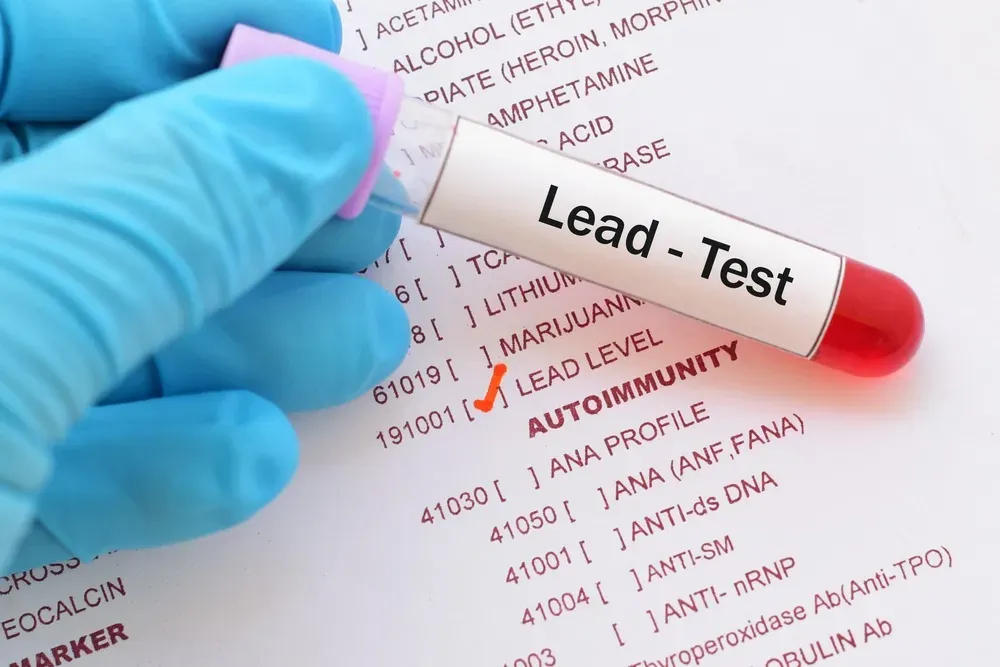 lead test