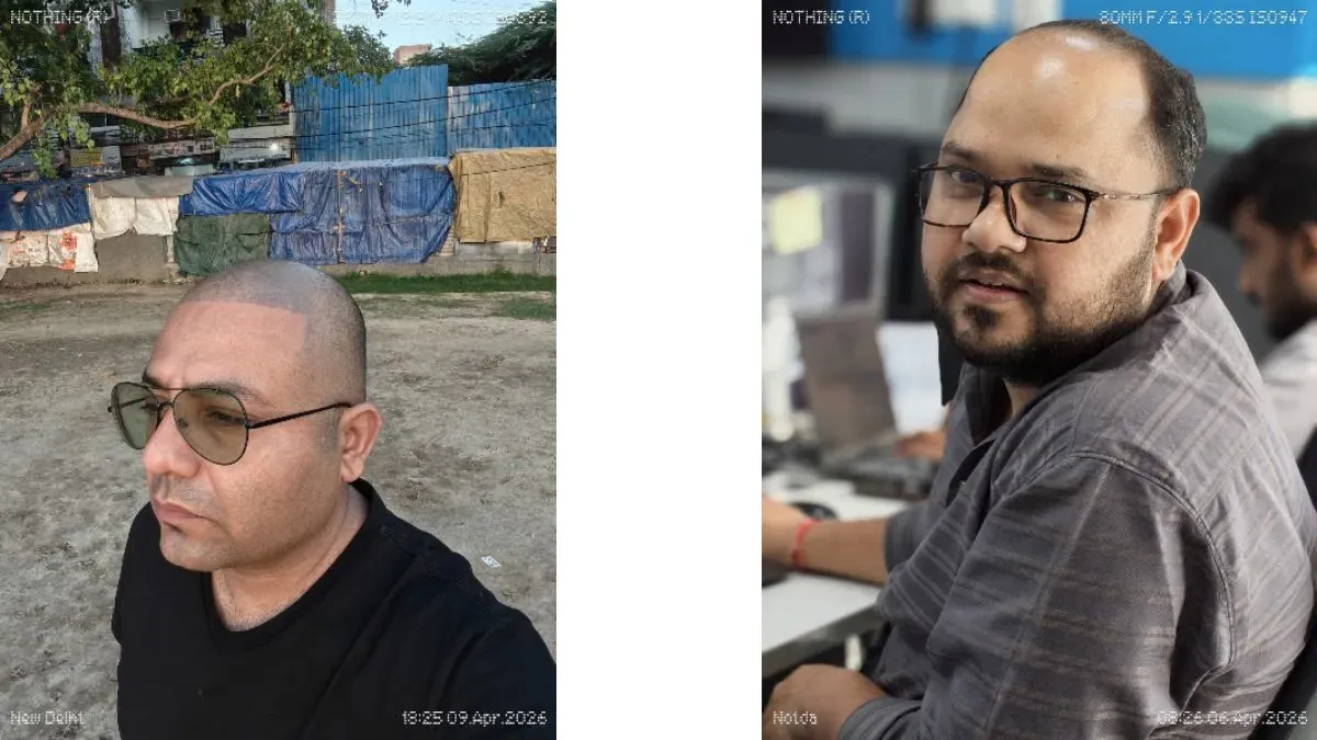 Nothing Phone 4a Pro