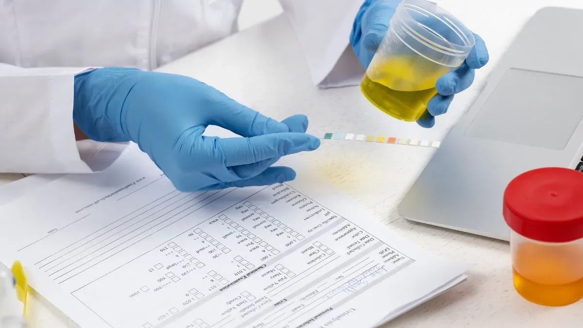 urine routine test