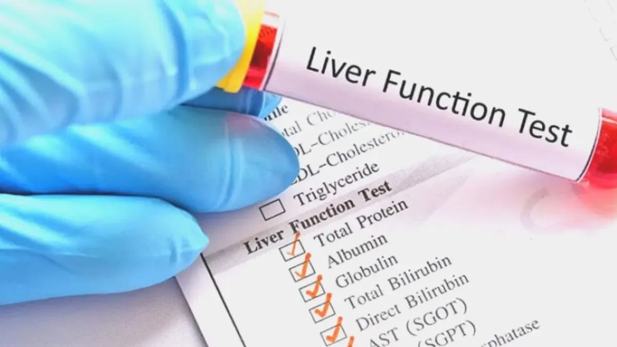 liver function test