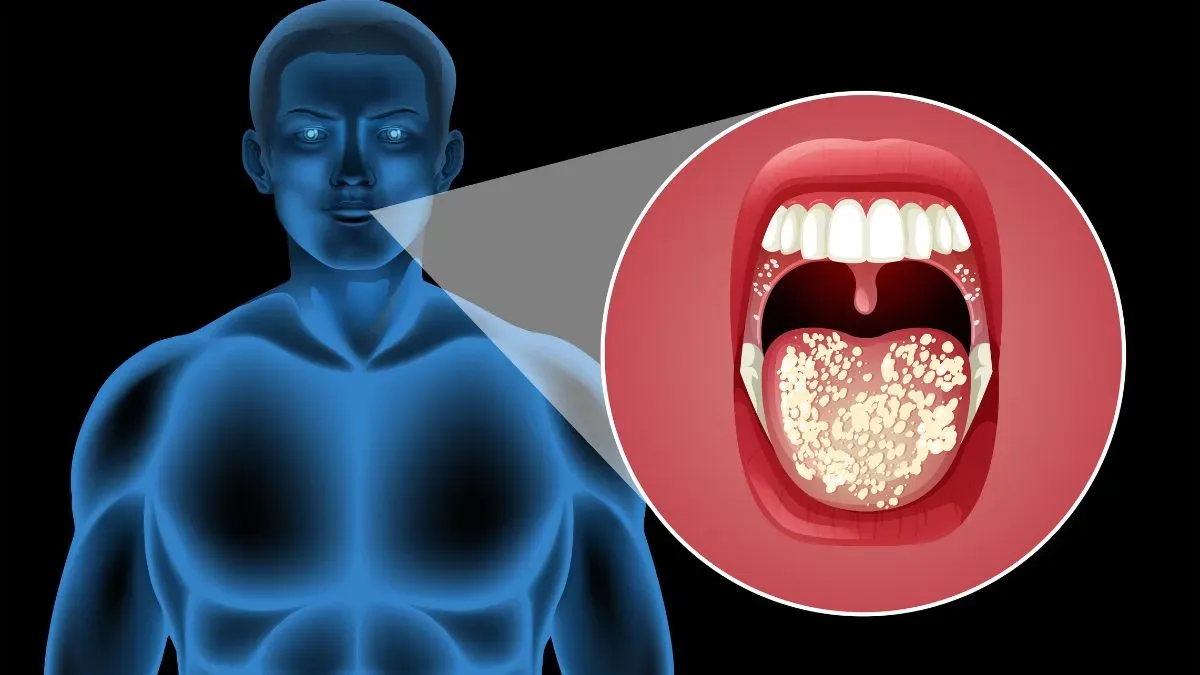 oral cavity