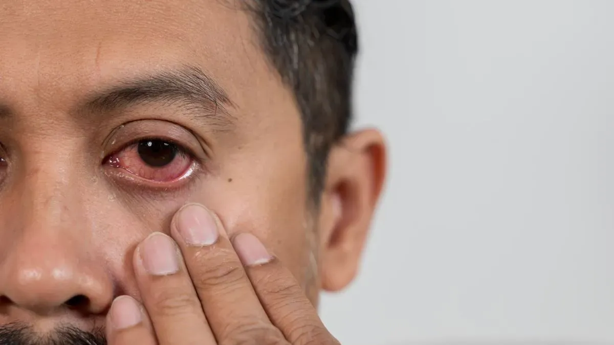 eye infection