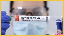 monkeypox