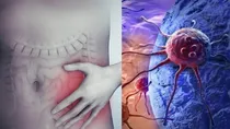 Cancer drug Dostarmilab