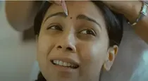 Dandruff in eyebrows