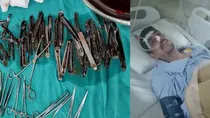 Doctors took out 63 spoons from patients stomach in Muzaffarnagar
