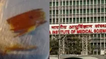 aiims delhi