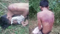 Muslim boy beaten in Dakshina Kannada