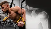 sehat shoulder dislocation
