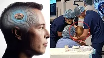 Elon Musk's brain-implant company Neuralink on Thursday said the U.S. Food and Drug Administration (FDA) had given the green light to its first-in-human clinical trial