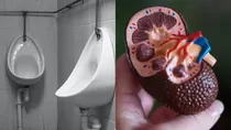 risks of yellow urine 