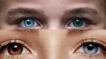 heterochromia
