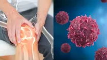 vitamin d deficiency can cause cancer