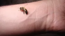 honey bee bite 