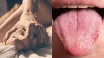oral cancer