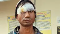 woman allegedly stabbed scissors in husband eye domestic dispute tea baghpat viral news