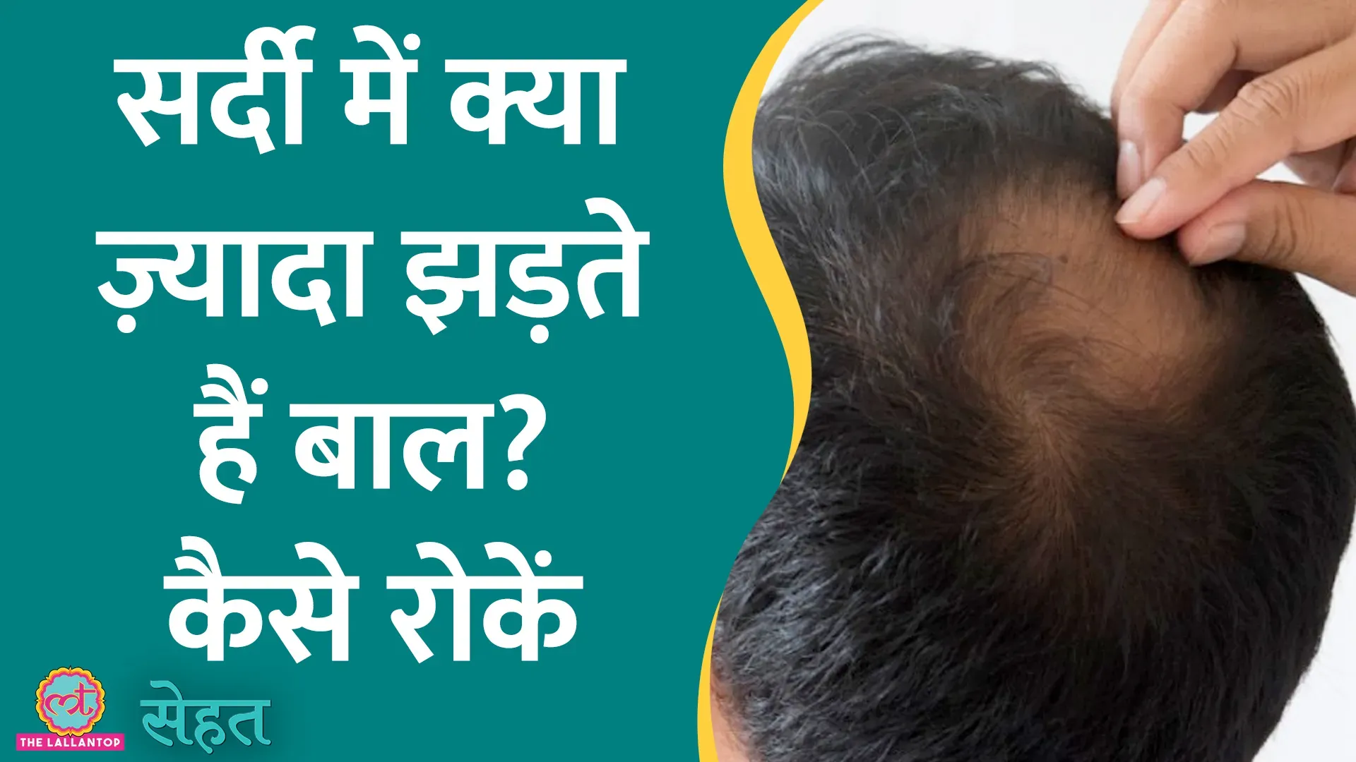 Hair Fall In hair-fall-in