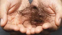 hairfall_in_winter