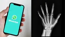 Too much of instant messaging on smartphones can damage your health, says a doctor in Spain, who has diagnosed the problem as 'WhatsAppitis' and reported its symptoms and treatment in the latest issue of reputed medical journal, The Lancet.