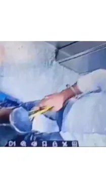  dog beaten in lift