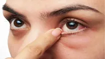 how does summer heat affect our eyes and tips to Save Eyes from the extreme Heat