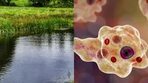 Rare Brain-Eating Amoeba Infection