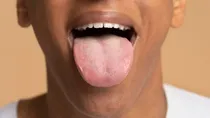 know everything about dry mouth its causes risks and treatment