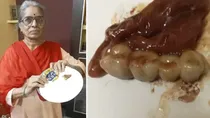 elderly teacher finds artificial teeth in chocolate toffee student birthday khargone mp news
