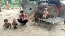 uttar pradesh ballia famliy have a strange eye disease viral news