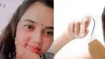 varanasi girl commits suicide hairfall 